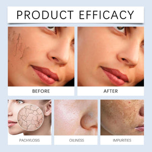 DEJIN Hyaluronic Acid Powder - Pure and Natural Hyaluronic Acid Powder for Face and Skin Care, Water-Soluble and Vegan with Low Molecular Weight, Ideal for DIY Facial Serum and Anti-Aging Treatments.