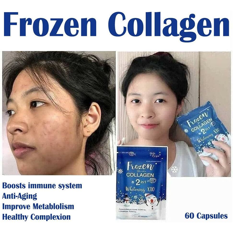 Frozen Collagen 2In1 Whitening X10