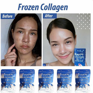 Frozen Collagen 2In1 Whitening X10