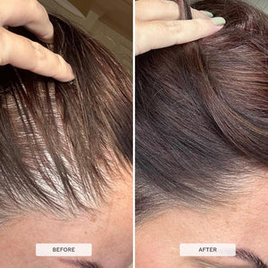 HAIR BURST Biotin Gummies - Skin & Nails Vitamin Supplement 1 Month