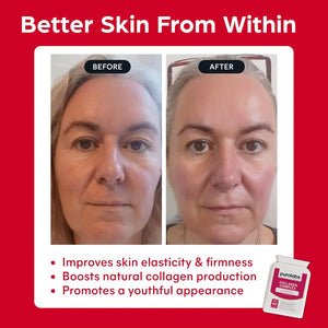 Purolabs Marine Collagen Complex - Collagen Supplement for Women & Men - with Hyaluronic Acid & Vitamin C - High Strength Type 1 Hydrolyzed Collagen Peptides - 60 Capsules - Skin, Hair & Nails