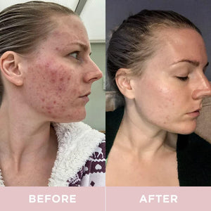 Revive Collagen Premium 8,500Mg Hydrolysed Marine Collagen Drink with Added Hyaluronic Acid & Aloe Vera for Healthy Skin, Hair, Nails & Joints | Lemon & Lime | 28 X Sachets