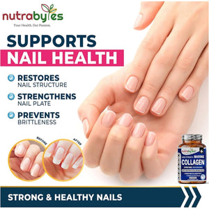 High Strength Marine Collagen 2400Mg with Hyaluronic Acid 100Mg, Biotin, Vitamin C, D3, B12 and Silica - 120 Capsules - High Strength Hydrolysed Marine Collagen for Men and Women, Made in UK