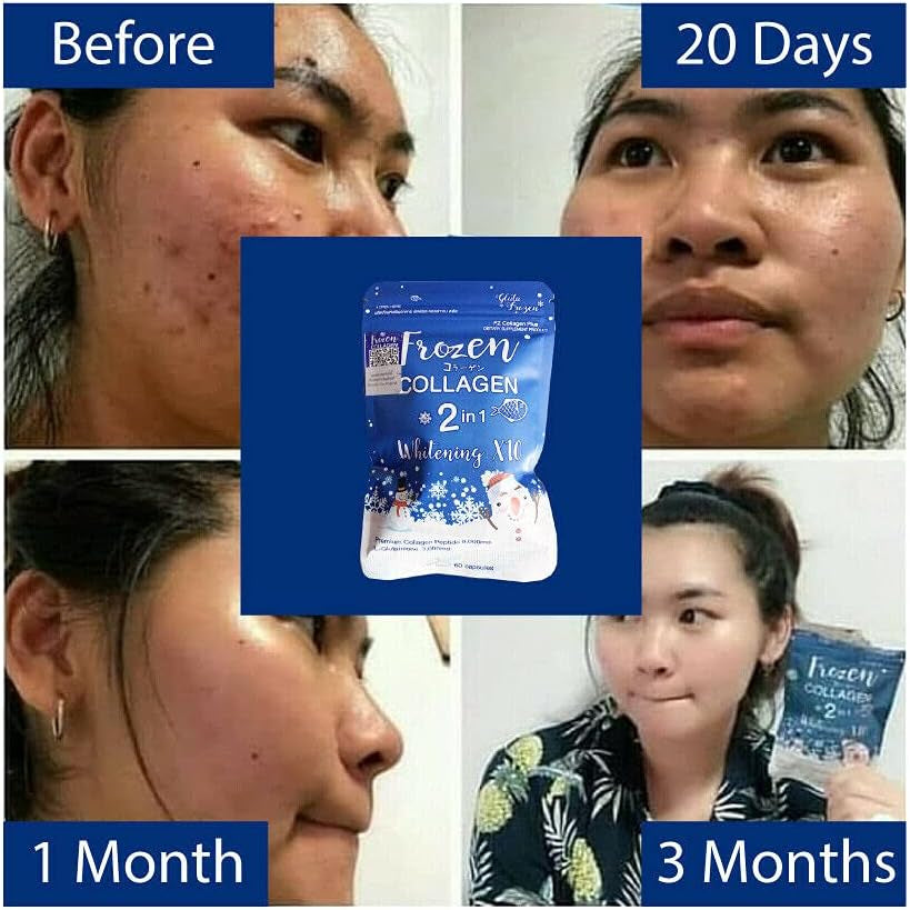 Frozen Collagen 2In1 Whitening X10