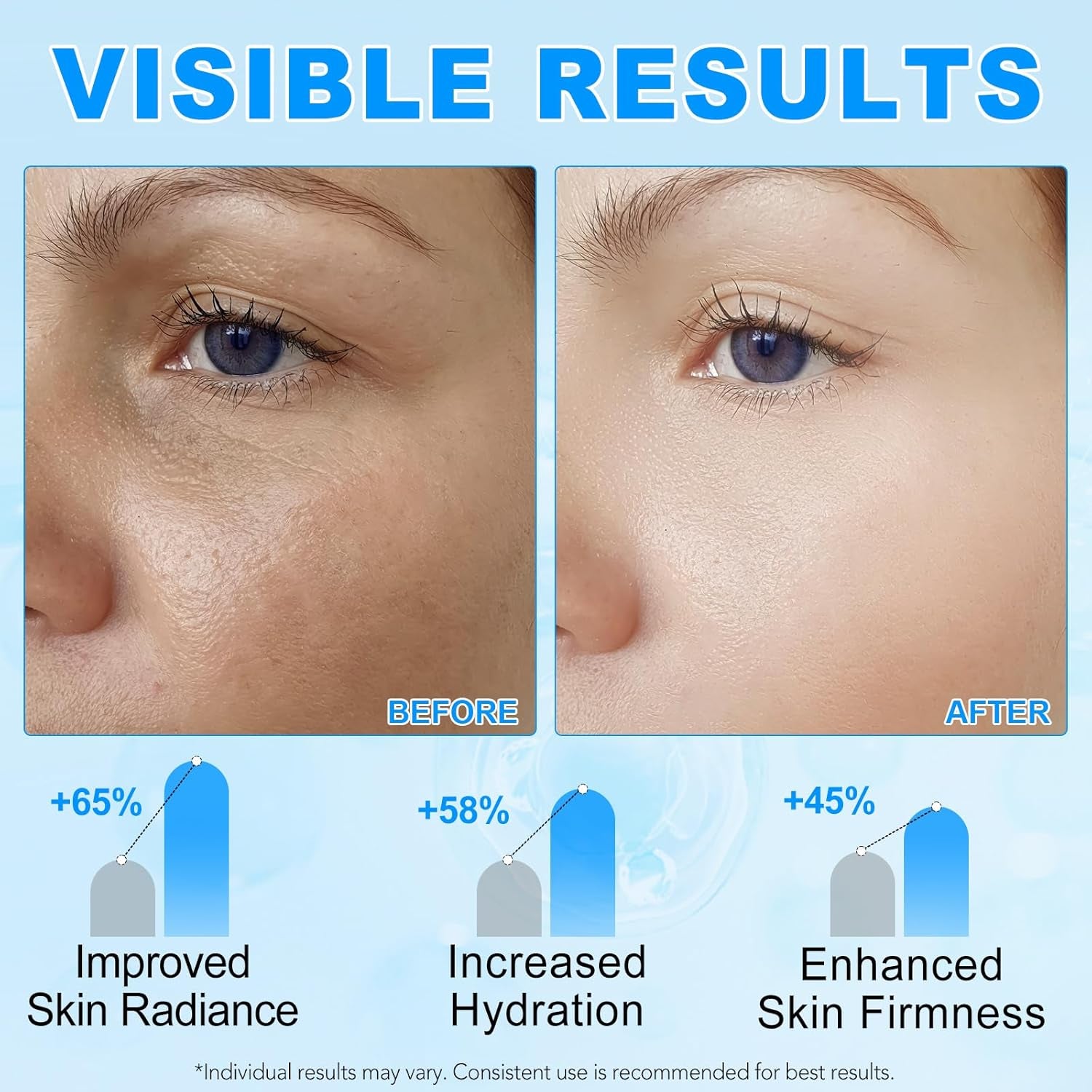 Hyaluronic Acid Powder, Water-Soluble High Molecular Weight Hyaluronic Acid Serums Powder, Water Soluble Hydrating Ingredient for Skin Moisture, Hyaluronic-Skincare-Molecular-Hydrating-Ingredient