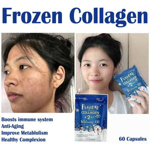 Frozen Collagen 2In1 Whitening X10