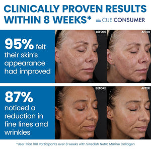 Swedish Nutra - Hydrolyzed Marine Collagen Liquid Supplement - Pack of 500 Ml, 20 Day Supply | Pure Peptide and Vitamins for Healthy Hair, Skin, Nails and Joints I 100% Natural Berry Flavour