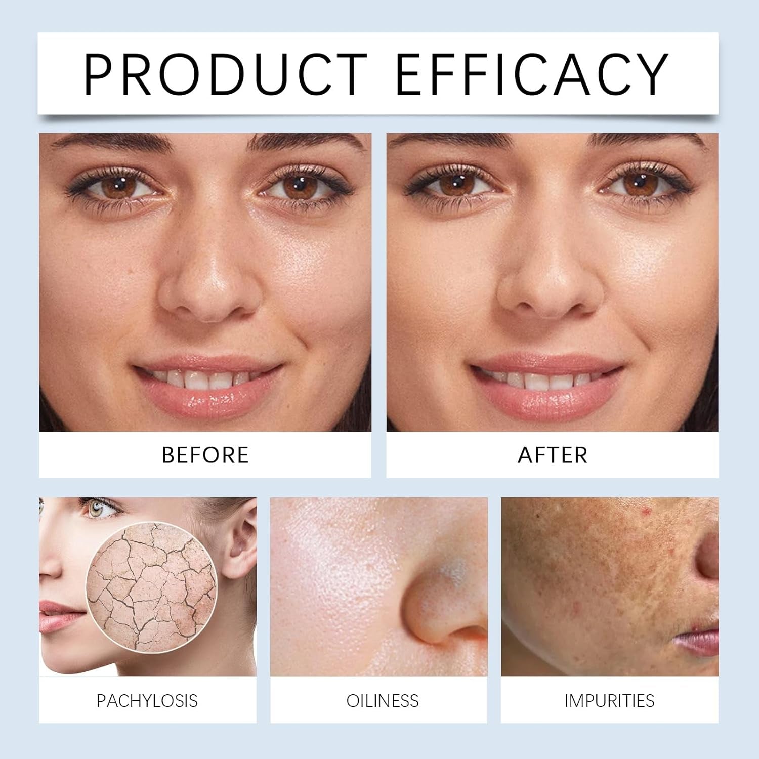 Acid Hyaluronic Powder,Water Soluble Hydrating Ingredient for Skin Moisture,Water-Soluble Firming Facial Serums Cosmetics,Micro Ingredients Hyaluronic Acid Powder, Skin Moisturising Support